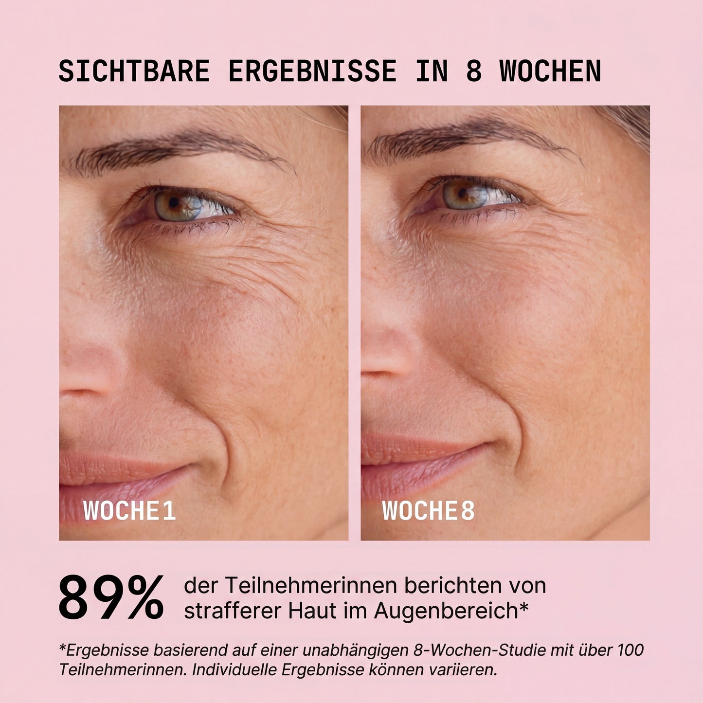 ElixEssence PureGlow Face Device