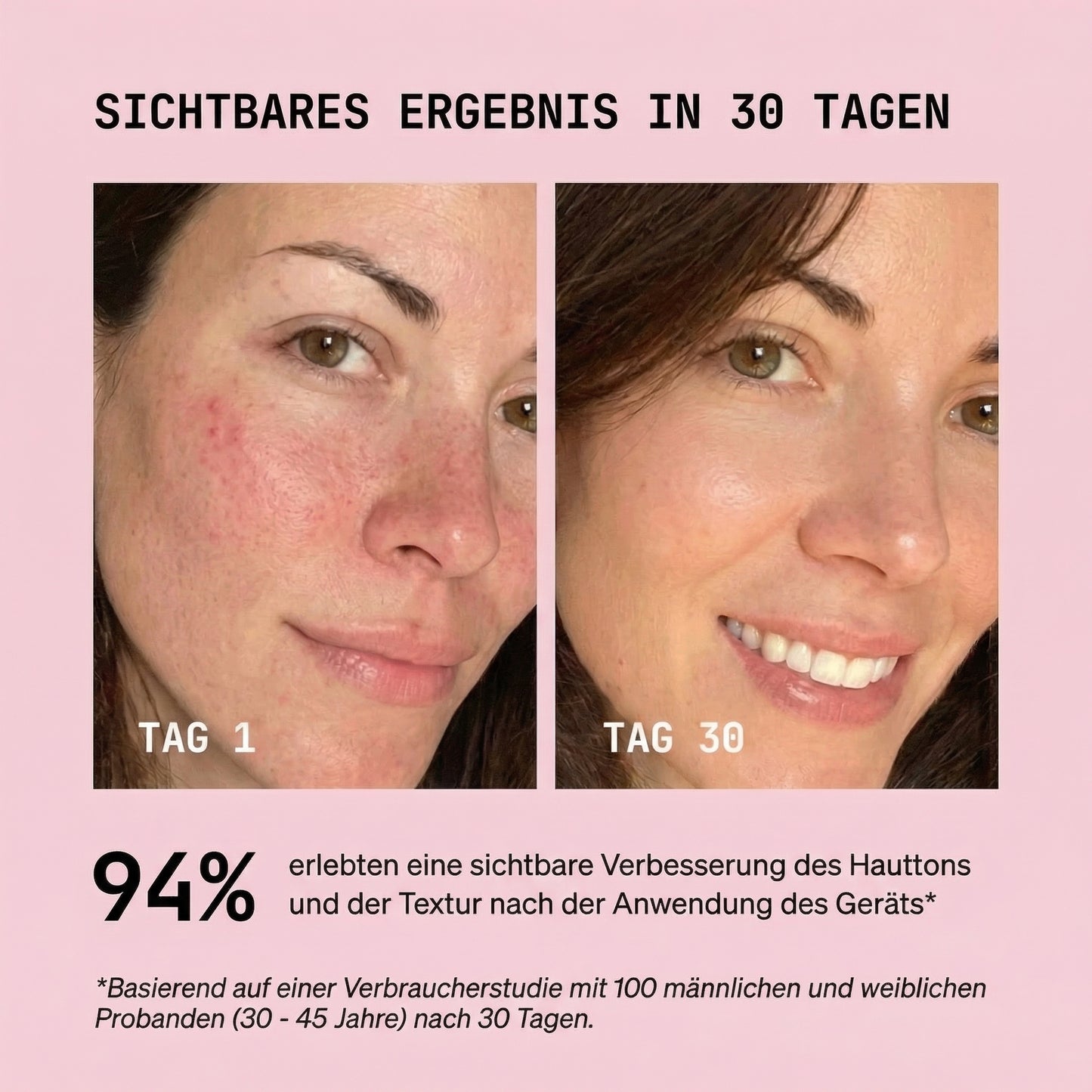 ElixEssence SlimLift Kontur Device