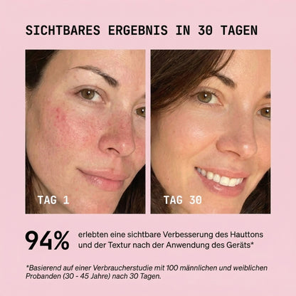 ElixEssence SlimLift Kontur Device