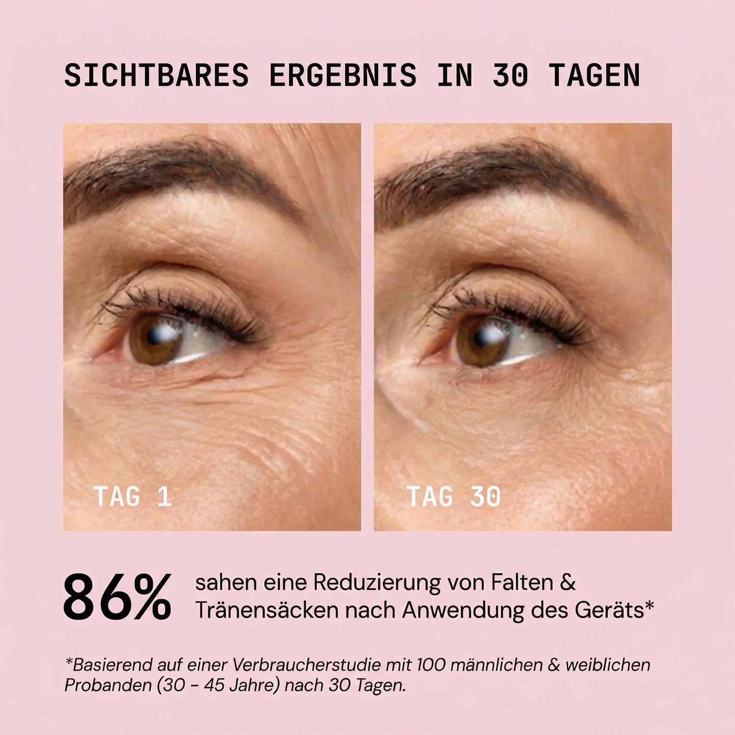 ElixEssence SlimLift Kontur Device